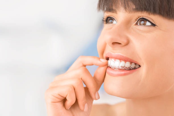 Invisalign vs. Traditional Braces: Which is Right for Your Lifestyle?